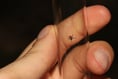 Opinion: Woeful record on Lyme disease shows NHS must heed evidence