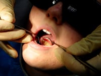 Almost a dozen hospital admissions in East Hampshire to remove children's rotten teeth
