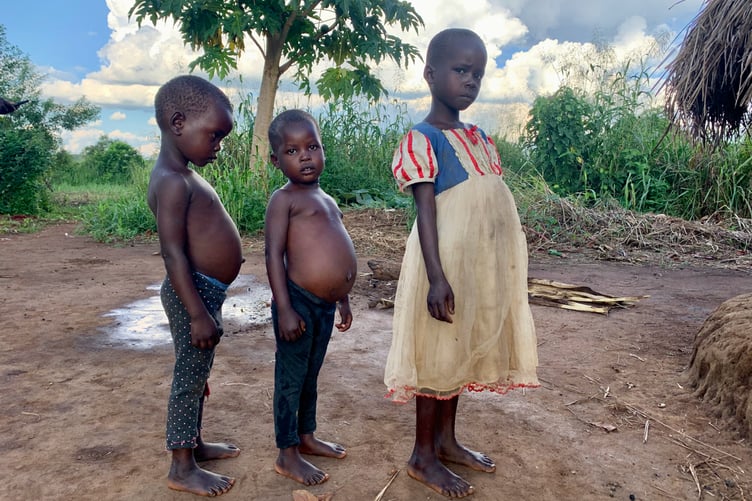 Ugandan children showing signs of malnutrition.