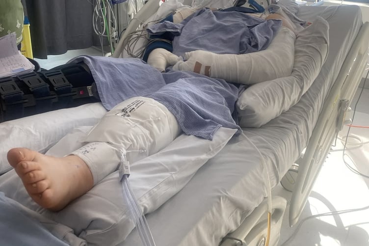 Dom in a full body case following the accident on July 4